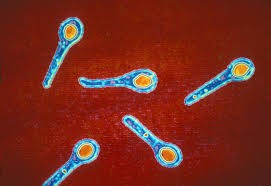 ID Tetanus Image