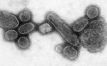 Spanish Flu Picture
