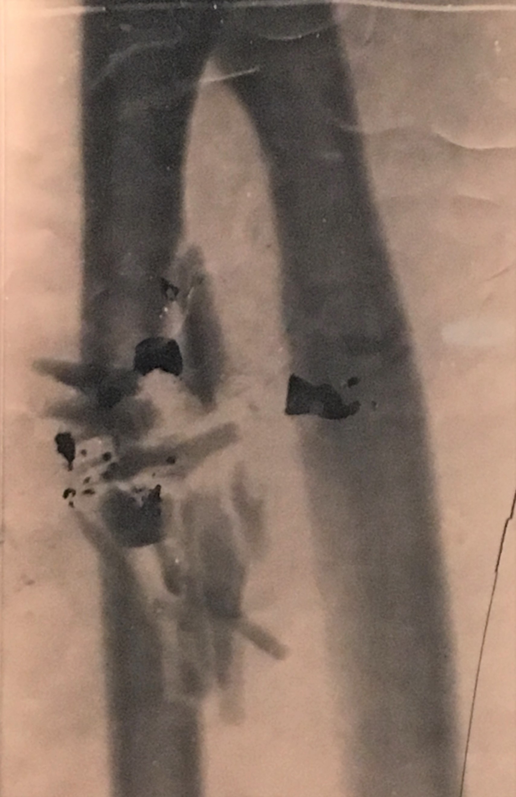 Radiograph, World War I